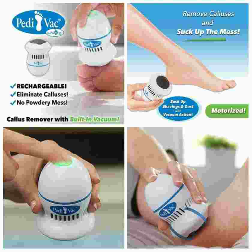 Calluses Remover